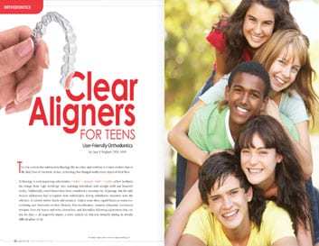 Clear aligners for teens article featuring diverse group of smiling teenagers and close-up of aligner tray.