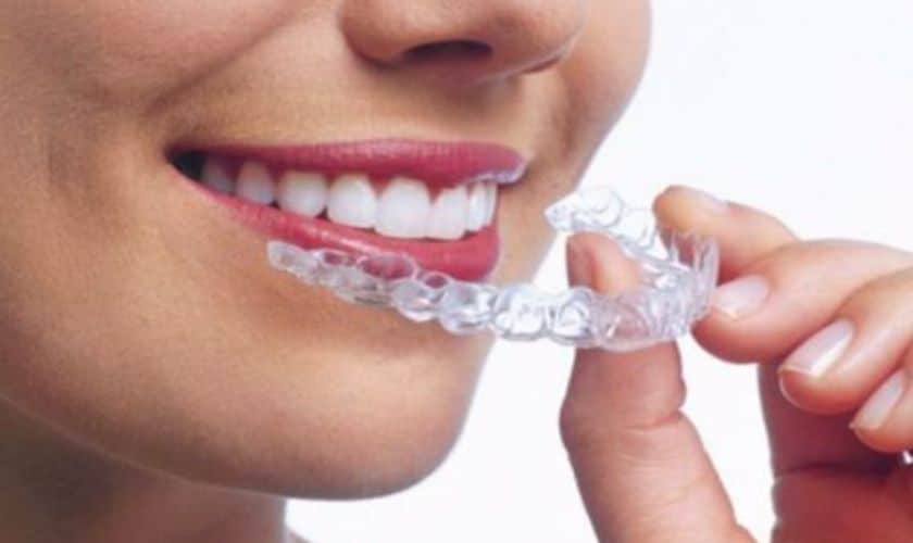 Invisalign in Lenexa