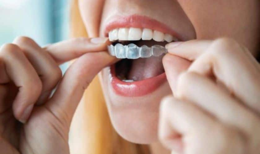 Invisalign in Prairie Village