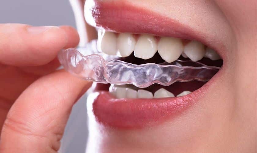Teen holding clear Invisalign aligner tray showing straightened teeth and proper orthodontic treatment in Prairie Village.