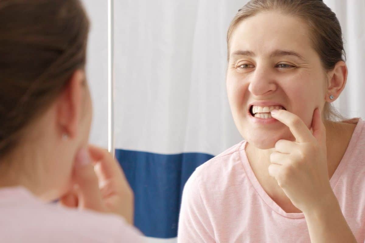 Featured image for “Is Orthodontic Relapse Common in Adults?”