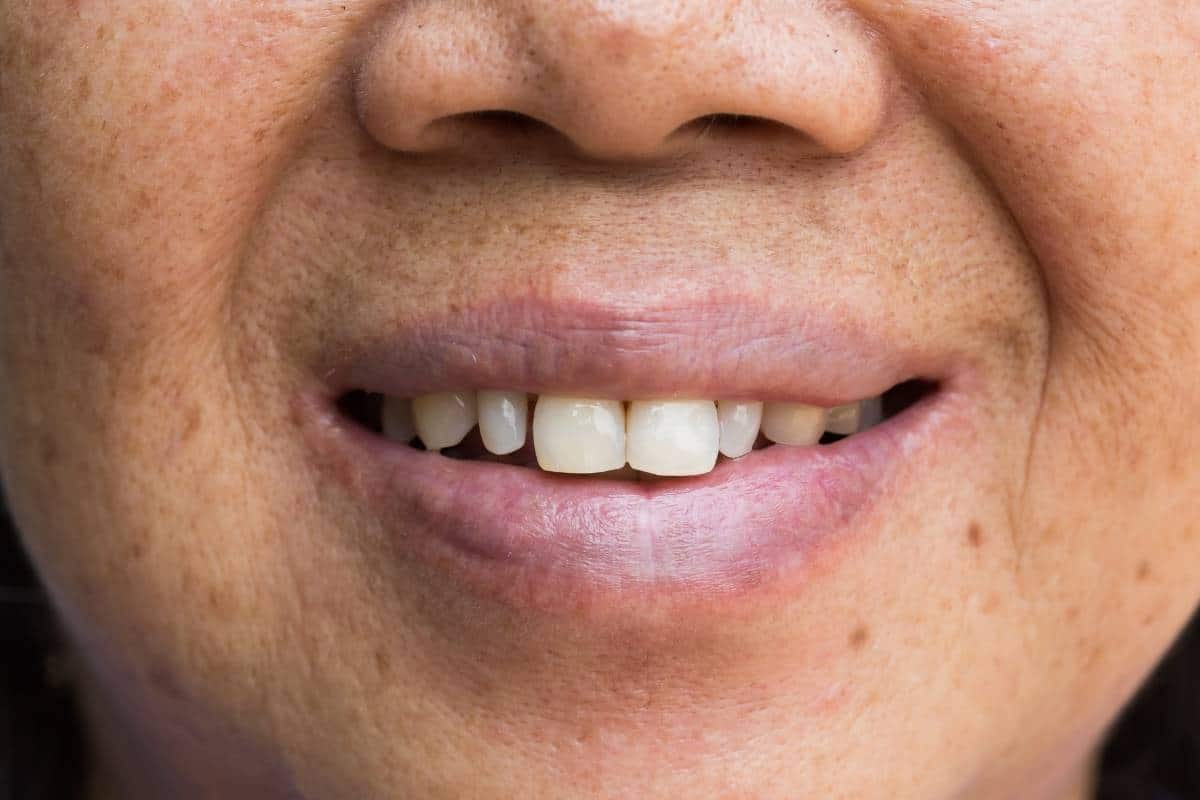Featured image for “Simple Ways to Close Gaps Between Teeth and Improve Your Smile”