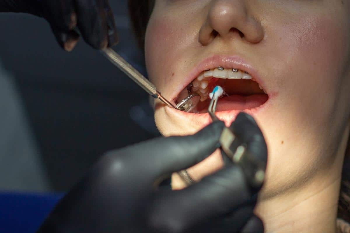 Dentist using instruments to repair broken braces wire during emergency dental treatment.
