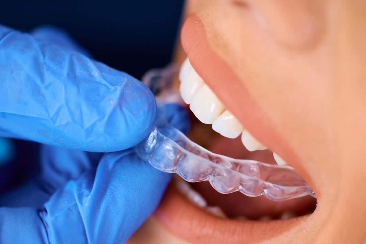 Dentist holding clear Invisalign aligner tray next to patient's teeth during orthodontic treatment.