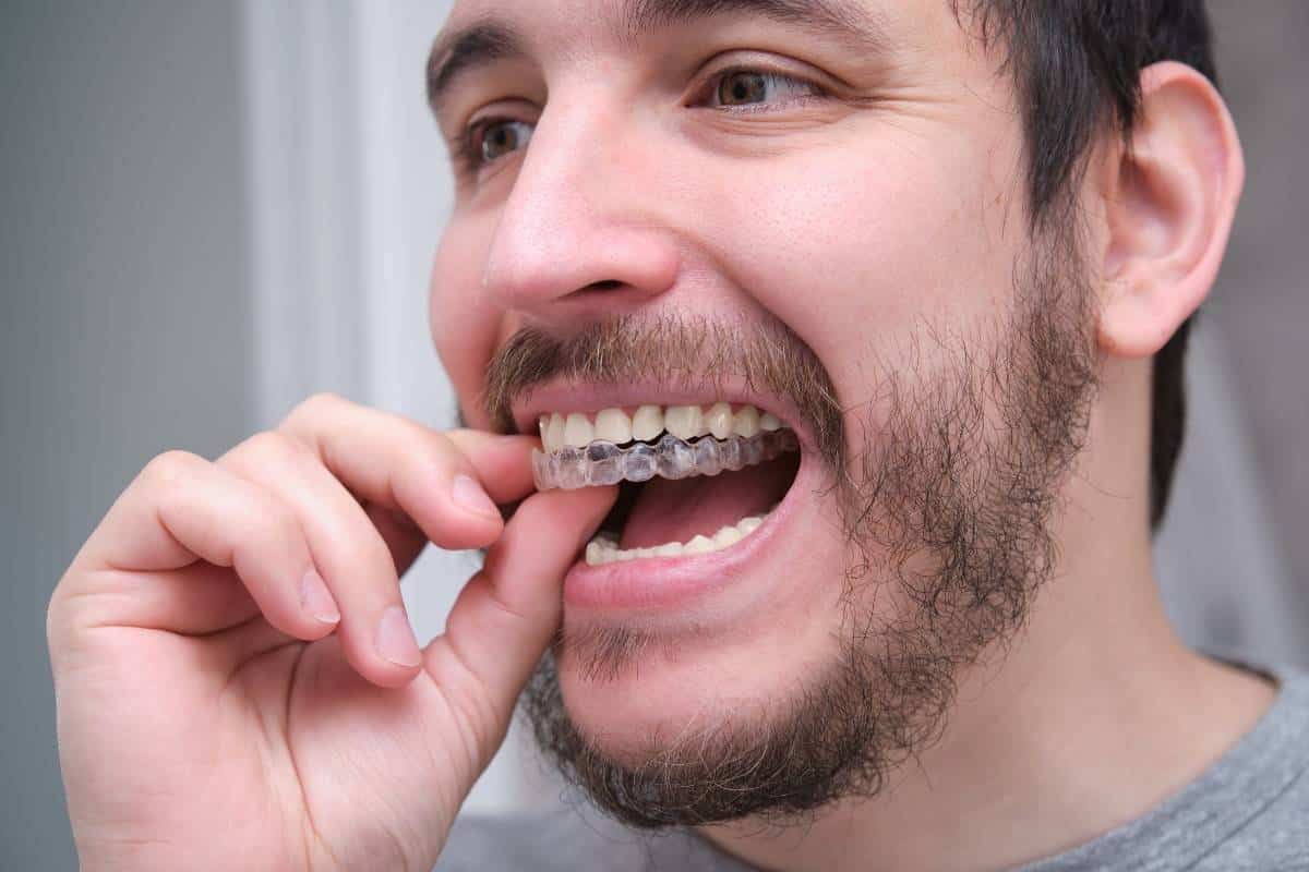 Clean Teeth During Orthodontic Treatment