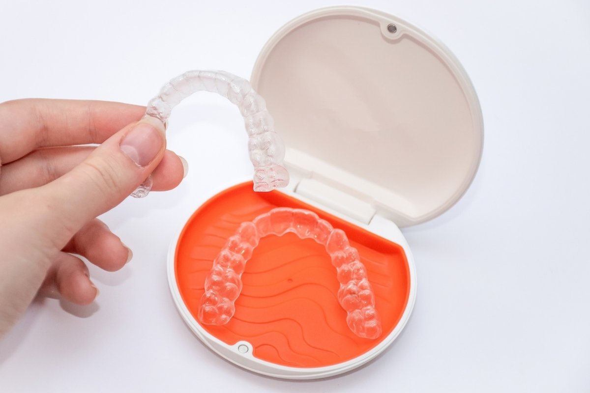 Featured image for “Can Orthodontic Treatment Fix an Underbite Without Jaw Surgery?”